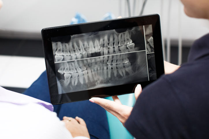 radiografia-2d-digital-sisorad