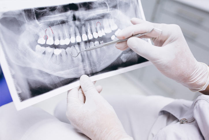 radiografia-2d-digital-sisorad2
