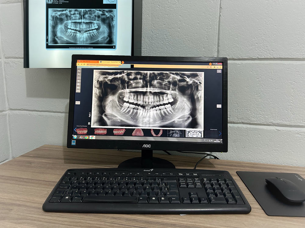 sisorad-radiologia-itu02